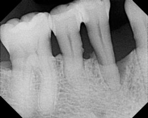 Dental X Ray Dose Chart